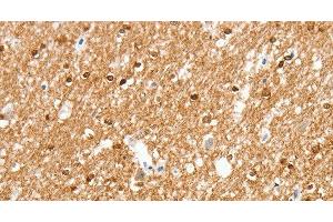 Immunohistochemistry of paraffin-embedded Human brain using AMZ1 Polyclonal Antibody at dilution of 1:80 (AMZ1 antibody)