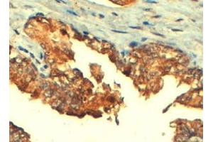 Immunohistochemistry (IHC) image for anti-ATP-Binding Cassette, Sub-Family C (CFTR/MRP), Member 4 (ABCC4) (C-Term) antibody (ABIN185302)