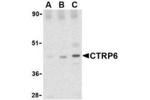 Western blot analysis of CTRP6 in mouse brain cell lysate with AP30257PU-N CTRP6 antibody at (A) 0. (CTRP6 antibody  (Intermediate Domain))