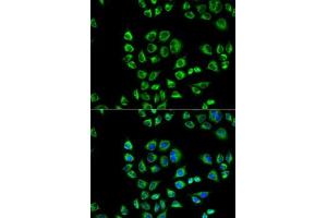 Immunofluorescence analysis of HeLa cells using CD1D antibody (ABIN3022497, ABIN3022498, ABIN3022499 and ABIN6218859). (CD1d antibody  (AA 20-190))
