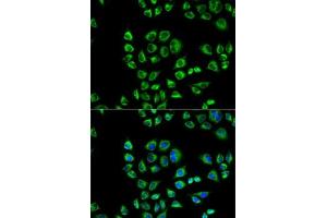 Immunofluorescence analysis of HeLa cells using CD1D antibody (ABIN3022497, ABIN3022498, ABIN3022499 and ABIN6218859). (CD1d antibody  (AA 20-190))