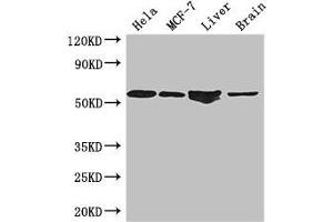 Western Blot Positive WB detected in: Hela whole cell lysate, MCF-7 whole cell lysate, Mouse liver tissue, Mouse brain tissue All lanes: ETS2 antibody at 2. (ETS2 antibody  (AA 9-185))