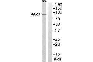 Western Blotting (WB) image for anti-P21 Protein (Cdc42/Rac)-Activated Kinase 7 (PAK7) (C-Term) antibody (ABIN1852718) (PAK7 antibody  (C-Term))