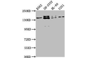 Western Blot Positive WB detected in: K562 whole cell lysate, SH-SY5Y whole cell lysate, HL-60 whole cell lysate, U251 whole cell lysate All lanes: AHI1 antibody at 1:2000 Secondary Goat polyclonal to rabbit IgG at 1/50000 dilution Predicted band size: 138, 121, 71 kDa Observed band size: 138 kDa (AHI1 antibody  (AA 1-213))