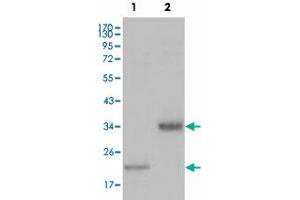 Western blot analysis using LPA monoclonal antibody, clone 8F6A9  against truncated LPA-His recombinant protein (1) and truncated Trx-LPA(aa 4330-4521) recombinant protein (2).