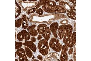 Immunohistochemical staining of human kidney with STARD10 polyclonal antibody  shows cytoplasmic and nuclear positivity in cells in tubules. (STARD10 antibody)
