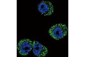 Immunofluorescence (IF) image for anti-Chemokine (C-C Motif) Receptor 7 (CCR7) antibody (ABIN5021834) (CCR7 antibody)