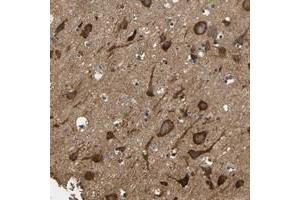 Immunohistochemical staining of human cerebral cortex with LRRCC1 polyclonal antibody  shows strong cytoplasmic positivity in neuronal cells.