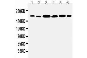 Anti-Laminin gamma 1 antibody, Western blotting Lane 1: Rat Kidney Tissue Lysate Lane 2: Rat Lung Tissue Lysate Lane 3: U87 Cell Lysate Lane 4: SMMC Cell Lysate Lane 5: HELA Cell Lysate Lane 6: SKOV1 Cell Lysate (Laminin gamma 1 antibody  (C-Term))
