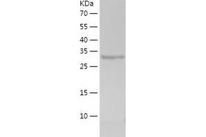Western Blotting (WB) image for S100 Calcium Binding Protein A6 (S100A6) (AA 1-90) protein (His-IF2DI Tag) (ABIN7124960) (S100A6 Protein (AA 1-90) (His-IF2DI Tag))