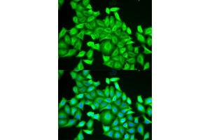 Immunofluorescence analysis of HeLa cells using RAB6A antibody (ABIN5973269). (RAB6A antibody)
