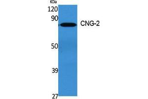 Western Blot (WB) analysis of specific cells using CNG-2 Polyclonal Antibody. (CNGA2 antibody  (Internal Region))