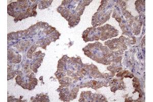 Immunohistochemistry (IHC) image for anti-Amelotin (AMTN) antibody (ABIN2716038) (Amelotin antibody)