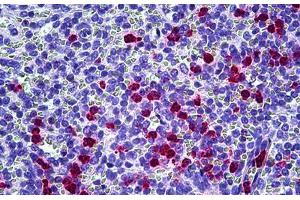 Anti-CAMP antibody IHC staining of human spleen, neutrophils. (Cathelicidin antibody)