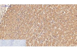 Immunohistochemistry of paraffin-embedded Human liver tissue using alpha Lactalbumin Monoclonal Antibody at dilution of 1:200. (LALBA antibody)