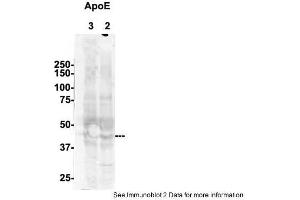 Sample Type: 2. (APOE antibody  (N-Term))