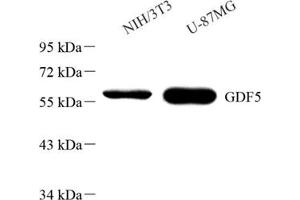 Western blot analysis of GDF5 (ABIN7074131)at dilution of 1: 1000 (GDF5 antibody)