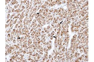 IHC-P Image Immunohistochemical analysis of paraffin-embedded U87 xenograft , using RELT, antibody at 1:100 dilution. (RELT antibody  (Center))