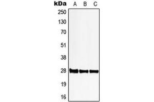 Western blot analysis of 6PGL expression in HeLa (A), SP2/0 (B), PC12 (C) whole cell lysates. (PGLS antibody  (C-Term))