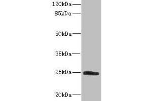 Western blot All lanes: SNRPB2 antibody IgG at 2. (SNRPB2 antibody  (AA 1-150))