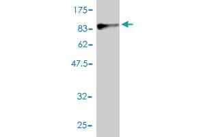 Western Blot detection against Immunogen (87. (Phosphoglucomutase 1 antibody  (AA 1-562))