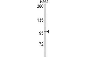 Western Blotting (WB) image for anti-Lipin 2 (LPIN2) antibody (ABIN3003814) (Lipin 2 antibody)