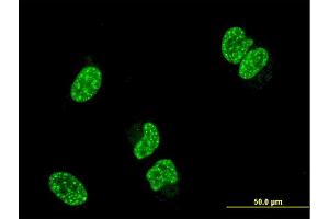 Immunofluorescence of monoclonal antibody to TP53RK on HeLa cell. (TP53RK antibody  (AA 154-253))