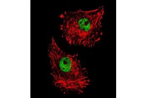 Confocal immunofluorescent analysis of FUS Antibody (C-term) (ABIN654146 and ABIN2844013) with MDA-M cell followed by Alexa Fluor 488-conjugated goat anti-rabbit lgG (green). (FUS antibody  (C-Term))