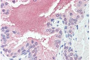 Anti-SLITRK6 antibody  ABIN960818 IHC staining of human prostate. (SLITRK6 antibody  (Cytoplasmic Domain))