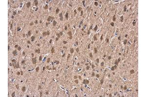 IHC-P Image HSP70 1A antibody detects HSP70 1A protein at cytoplasm in rat brain by immunohistochemical analysis. (HSP70 1A antibody  (Center))