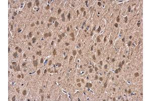 IHC-P Image HSP70 1A antibody detects HSP70 1A protein at cytoplasm in rat brain by immunohistochemical analysis.