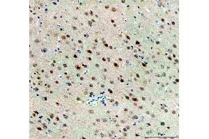 IHC analysis of FTO using anti-FTO antibody (ABIN7601059).