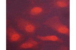 Immunofluorescence (fixed cells) (IF/ICC) image for anti-Checkpoint Kinase 2 (CHEK2) (pThr383) antibody (ABIN6256552)