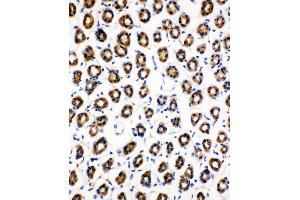 Anti-SDHC antibody, IHC(P) IHC(P): Rat Gaster Tissue (SDHC antibody  (N-Term))