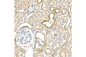 Immunohistochemistry of paraffin-embedded mouse kidney using B Rabbit pAb (ABIN6129977, ABIN6137413, ABIN6137415 and ABIN6220894) at dilution of 1:25 (40x lens).