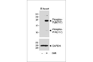 Western blot analysis of lysates from Rat heart tissue and spontaneous hypertensive (SHR) rat heart tissue lysate, using Phospho-PLB(T17) Antibody (ABIN650834 and ABIN2839801) (upper) or GDH (lower).