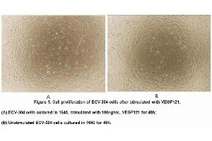 Image no. 3 for Vascular Endothelial Cell Growth Factor 121 (VEGF121) (AA 28-147) (Active) protein (His tag) (ABIN6239782) (VEGF121 Protein (AA 28-147) (His tag))