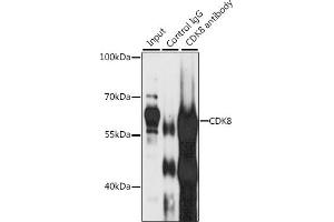 Immunoprecipitation analysis of 200 μg extracts of Jurkat cells, using 3 μg CDK8 antibody (ABIN6129240, ABIN6138329, ABIN6138330 and ABIN7101776).