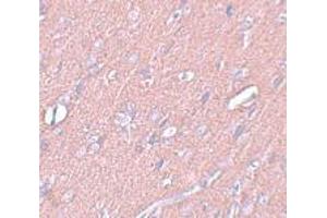 Immunohistochemistry (IHC) image for anti-Synaptogyrin 3 (SYNGR3) (C-Term) antibody (ABIN1030716) (Synaptogyrin 3 antibody  (C-Term))