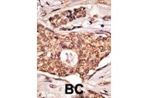 IHC analysis of FFPE human lymph node with ICOS antibody (ICOS antibody  (AA 156-185))