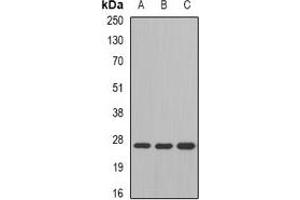 Western blot analysis of GSTM4 expression in SW480 (A), mouse liver (B), mouse lung (C) whole cell lysates. (GSTM4 antibody)