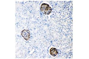IHC analysis of Nephrin using anti-Nephrin antibody (ABIN5518783).