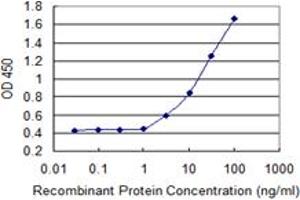 Detection limit for recombinant GST tagged ASMT is 1 ng/ml as a capture antibody. (ASMT antibody  (AA 71-170))