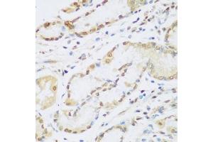 Immunohistochemistry of paraffin-embedded human stomach using CCND2 antibody (ABIN1875413) at dilution of 1:100 (40x lens). (Cyclin D2 antibody)