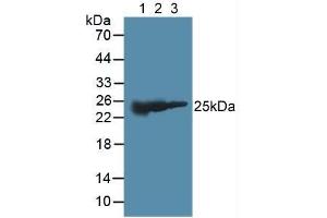 Figure. (GSTM2 antibody  (AA 3-218))