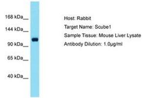 Image no. 1 for anti-Signal Peptide, CUB Domain, EGF-Like 1 (SCUBE1) (AA 518-567) antibody (ABIN6750516) (SCUBE1 antibody  (AA 518-567))