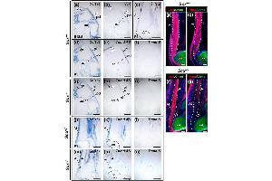 In situ hybridization (ISH) image for anti-Collagen, Type I (COL1) antibody (ABIN5596819)