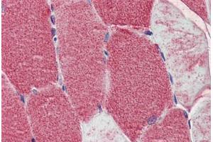Human Skeletal Muscle: Formalin-Fixed, Paraffin-Embedded (FFPE) (POLG antibody  (AA 829-1201))