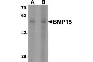 Western blot analysis of BMP15 in 3T3 cell lysate with BMP15 antibody at (A) 1 and (B) 2 µg/mL