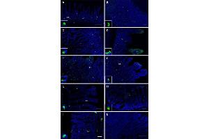 Visualization of OR51E1 tissue distribution in the gastrointestinal tract. (OR51E1 antibody)